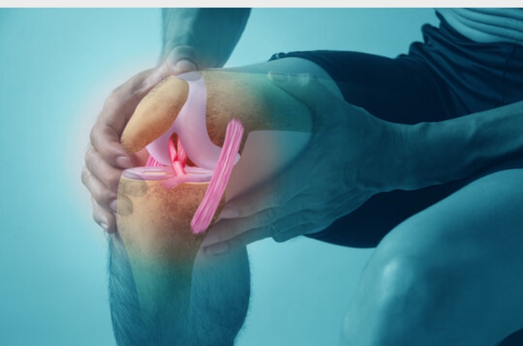 Ligament-Injuries-ACL-PCL-Tears-15.jpg