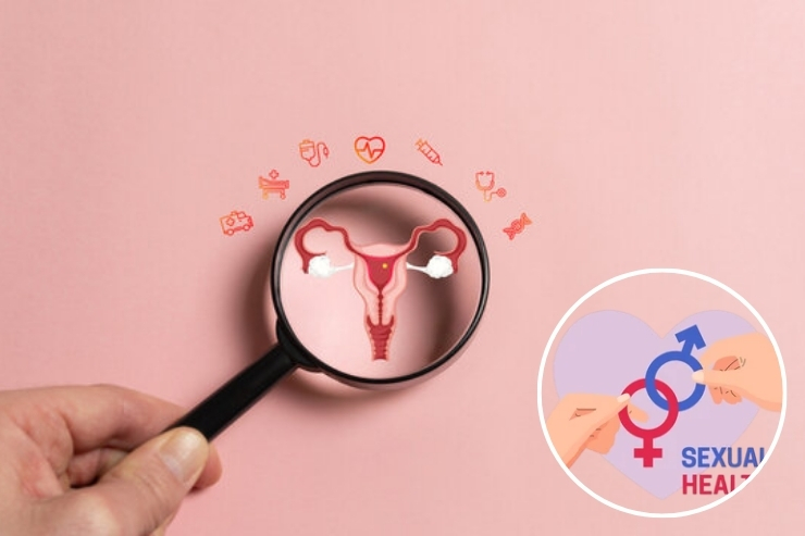 Sexual & Reproductive Health-----23