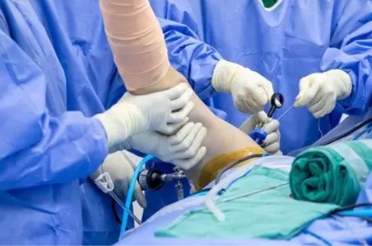 Shoulder-Arthroscopy-